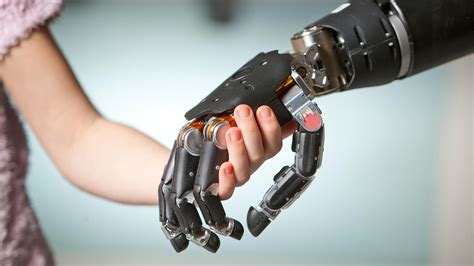 The Prosthetics Industry Gets A Human Touch Health News Florida
