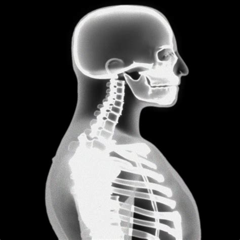 X Ray Skeleton Xray Body Human Obj