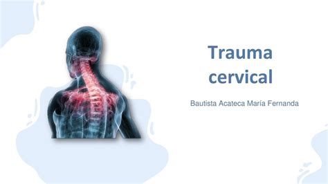 Trauma Cervical Maria Fernanda Bautista Acateca Udocz