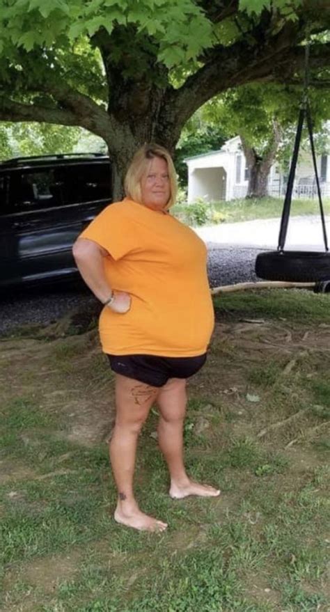 Friendsville Mom Loses 175 Lbs After Weight Loss Surgery Premier Surgical