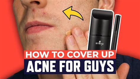 Quick And Easy Tips To Cover Up Acne How To Cover Up Acne For Guys