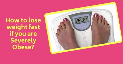 How To Lose Weight Fast If You Are Severely Obese Dr Maran