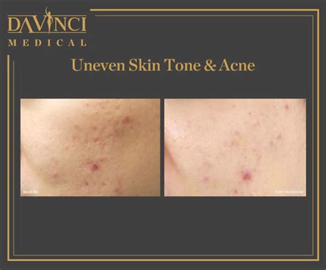 Da Vinci Clinic Skin Brightening Toning Rejuvenation Treatment