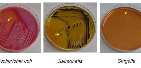 Salmonella Shigella Ss Agar Composition Principle Procedure And