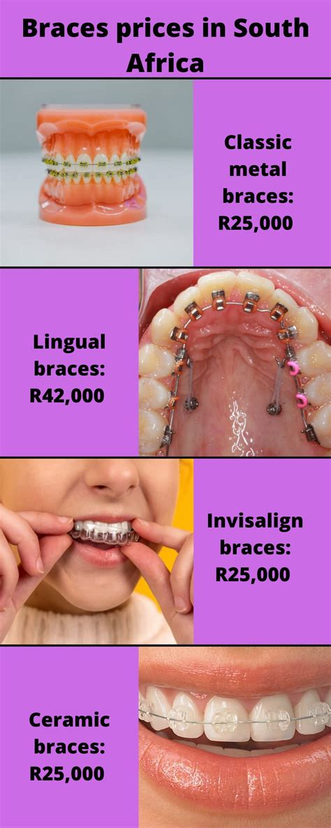 How Much Are Braces In South Africa 2023 Braces Price And Infographic