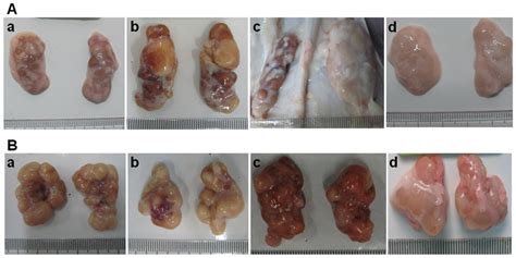 Clinical Pictures Of Inguinal A And Submandibular B Lymph Nodes In