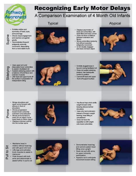 4 Month Typical And Atypical Development Physical Milestones