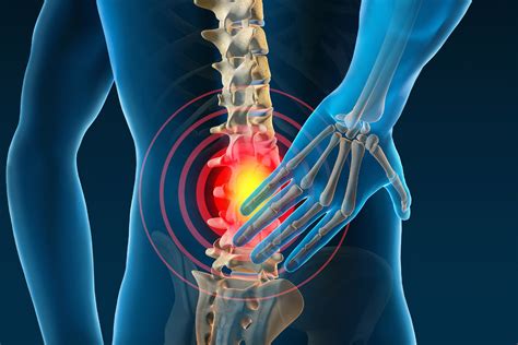 Understanding Of Low Back Pain With Recent Evidence Health Business