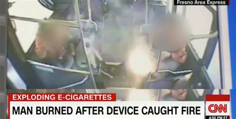 E Cigarette Explodes In Face Of Smoking Teenager Causing Horror