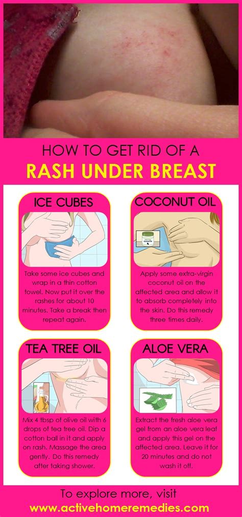 How To Get Rid Of A Rash Under Breasts Active Home Remedies