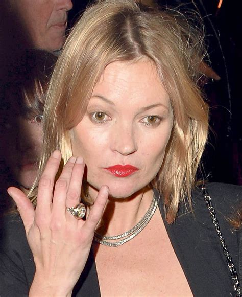 Kate Moss The Model Was Seen With Mysterious White Marks On Her Dress
