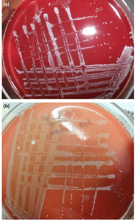 Colony Morphology Of Corynebacterium Pseudotuberculosis On Blood Agar