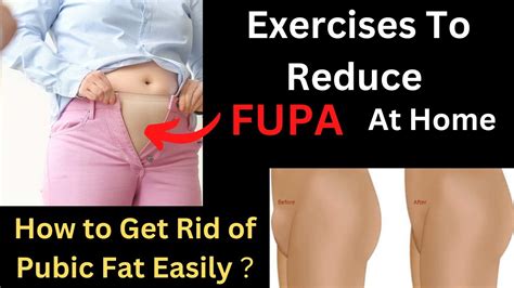 How To Get Rid Of Pubic Fat Easily Exercises To Reduce FUPA At Home