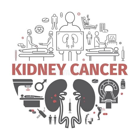 Kidney Cancer Symptoms Causes Diagnostics Flat Icons Set Vector