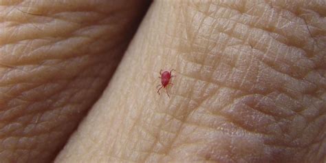 But some symptoms can show up more gradually. How to Get Rid of Chiggers - Eliminate Red Mites and Bugs ...