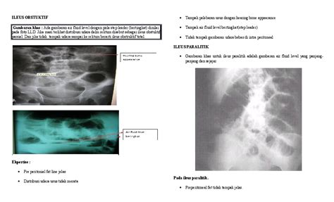 Doc Ileus Obstruktif Dan Ileus Paralitik Andri Putra