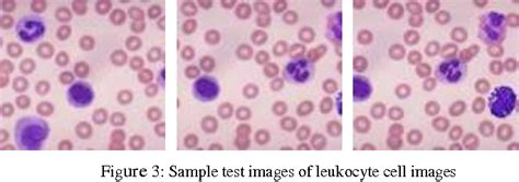 Blood Microscope Leukocytes Micropedia