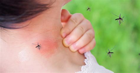 How Can I Prevent And Treat Mosquito Bites Fastmed Urgent Care