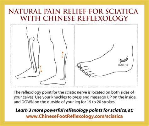 True injury to the sciatic nerve sciatica is actually rare, but the term sciatica is commonly used to describe any pain that originates in the lower back and radiates down the leg. sciatic pain | Chinese Reflexology with Holly Tse