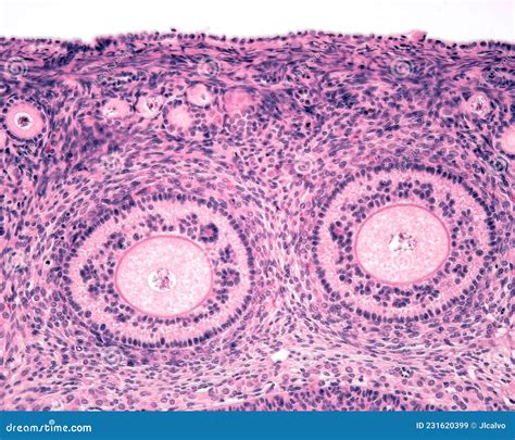 Ovarian Cortex Seconday Follicles Stock Illustration Illustration Of