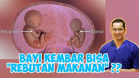 Kembar Kehamilan Yang Beresikodr Boy Abidin Youtube