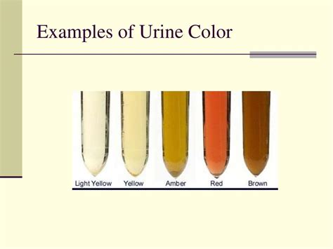 Ppt Examination Of Urine Powerpoint Presentation Id497429