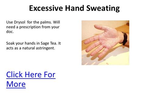 Excessive Hand Sweating