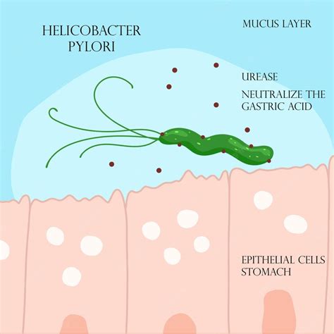 Premium Vector Helicobacter Pylori In Mucosal Layer In Stomach Infographic