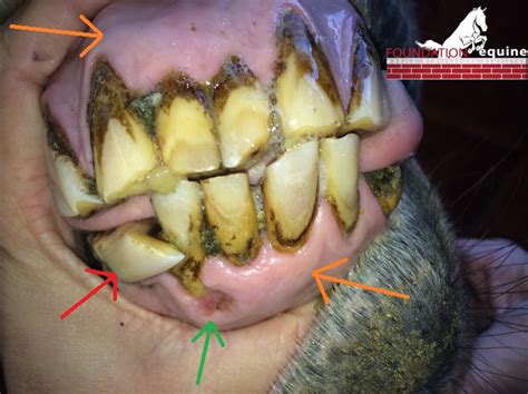 Those Arent Old Horse Teeth Thats Eotrh A Painful Condition Of