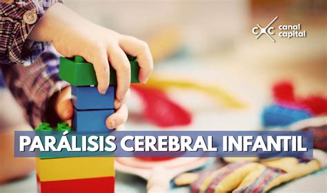 Todo Lo Que Debe Saber Sobre La Parálisis Cerebral Infantil