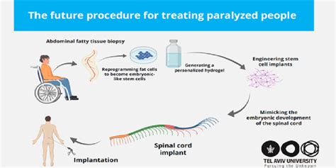 Israels Tau Breakthrough Offers New Hope To Help People With Paralysis