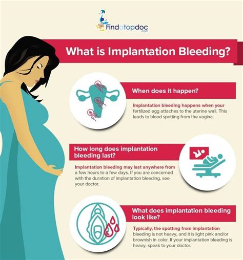 What Is Implantation Bleeding Infographic
