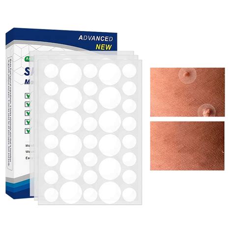 144pcsbox Skin Tags Removal Patches Natural Gentle Wart Remover Quick