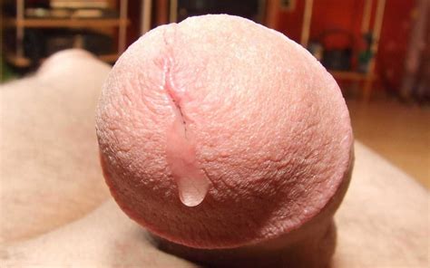 Erect Cocks 236 Pics 3 Xhamster