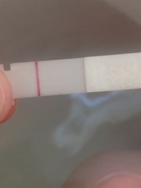 8 And 9dpo Strange Cervical Mucus Tmi Warning Photos Included Page 4 — Madeformums Forum