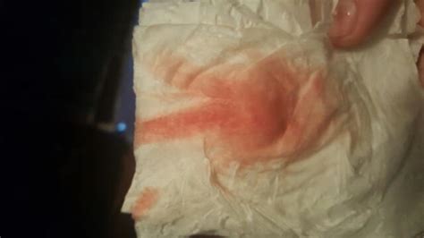 Is This Implantation Bleeding Yesterday Had Very Light Spotting But It