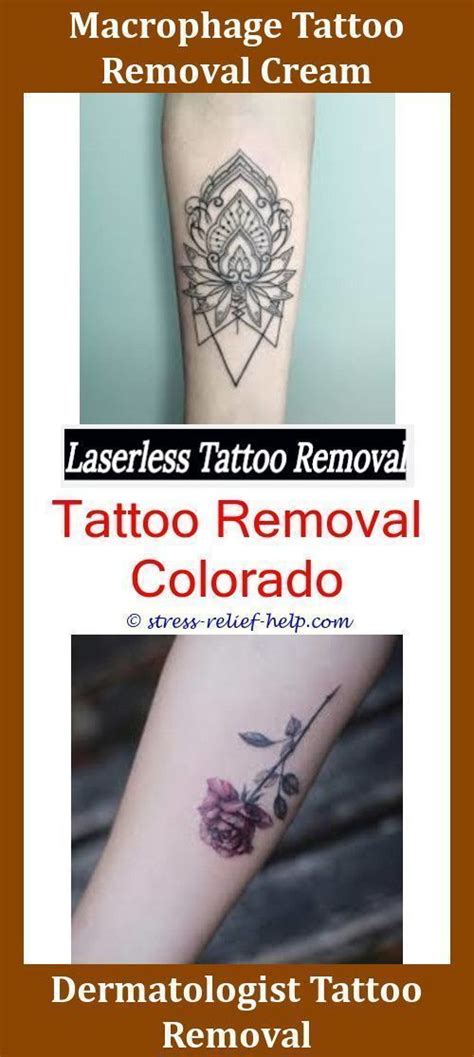 Laser tattoo removal is the safest and most effective means of eliminating an unwanted tattoo. Is Laser Tattoo Removal 100 Effective,permanent tattoo removal cost how to remove a tattoo ...