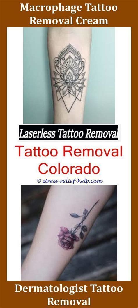 In either case, to completely get rid of a tattoo, it will take several. Is Laser Tattoo Removal 100 Effective,permanent tattoo ...