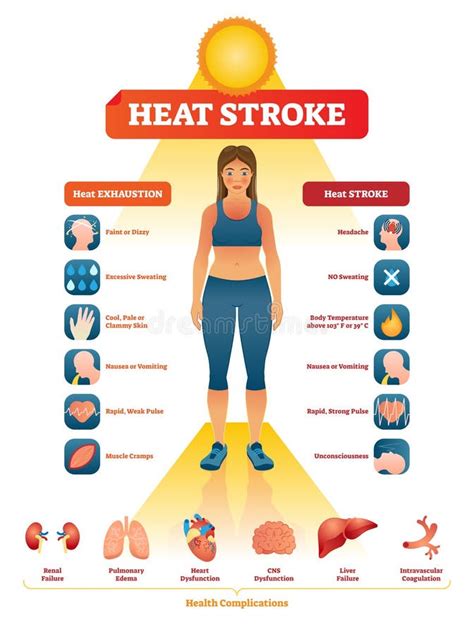 Heat Stroke Vector Illustration Exhaustion Symptoms Labeled Medical