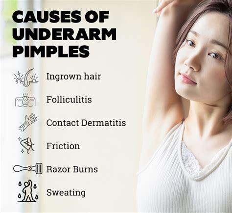 Got Pimples Under Armpit Here Is The Causes And Treatments