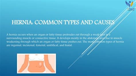 Hernia Common Types And Causes Ppt