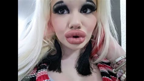 World Largest Lips How Did This Girl Set The World Record For The
