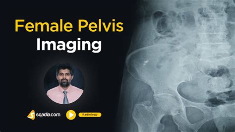 Female Pelvis Imaging Medical Radiology Online Lectures V Learning Sqadia Com YouTube