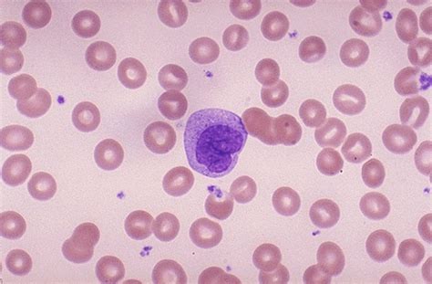 Normal White Blood Cells On A Smear Medical Laboratories
