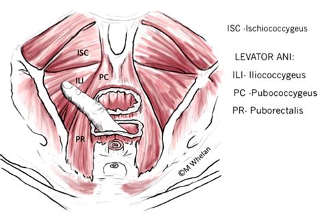 pelvic floor trigger points diagram free wiring diagram