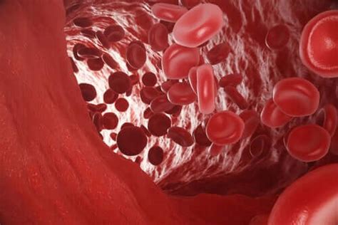Akuter kohlenmonoxidvergiftung chronischer kohlenmonoxidvergiftung 5.2 akute kohlenmonoxidvergiftung. Kohlenmonoxidvergiftung: Was tun? - Besser Gesund Leben