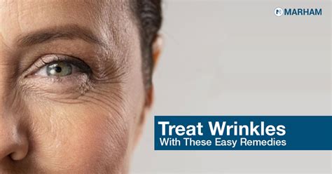 5 Effective Home Remedies To Treat Wrinkles Marham