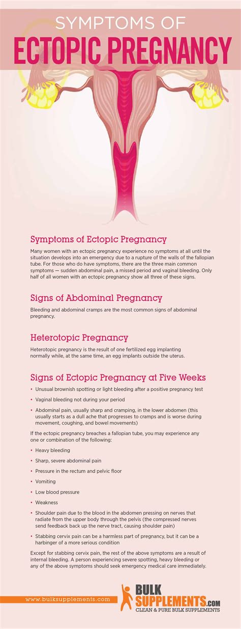 Ectopic Pregnancy Characteristics Causes And Treatment