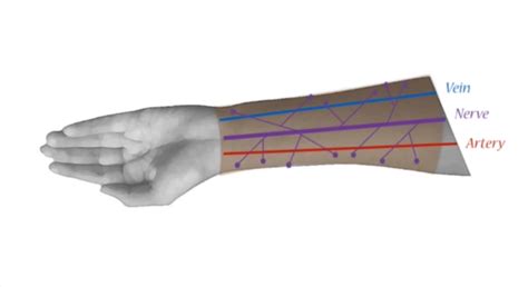 Aug 05, 2017 · también se lleva a cabo la faloplastia, que consiste en extraer un injerto de piel del brazo o del muslo para reconstruir un pene de unos 12 a 13 cm de longitud con capacidad de penetración. Transexualidad FTM: Conexión de nervios en la faloplastia para obtener sensibilidad (explicado ...