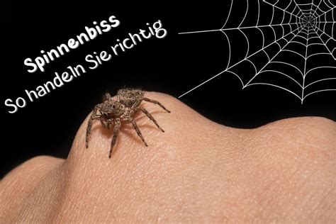 Spinnenbiss Was Tun Wenn Man Von Einer Spinne Gebissen Wurde Gartenlexikon De